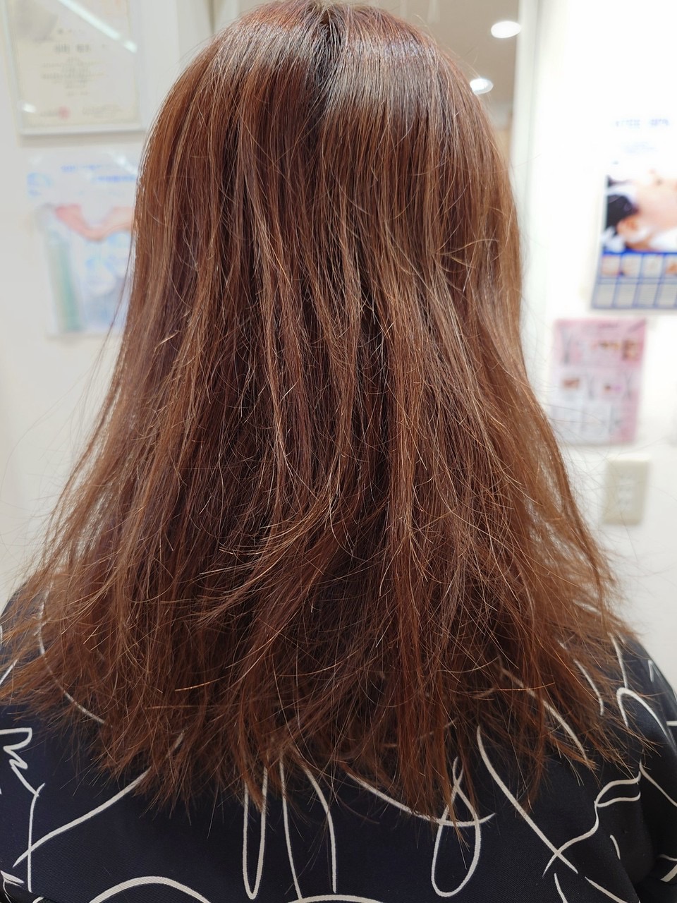 スキャルプアクアジェット施術後
